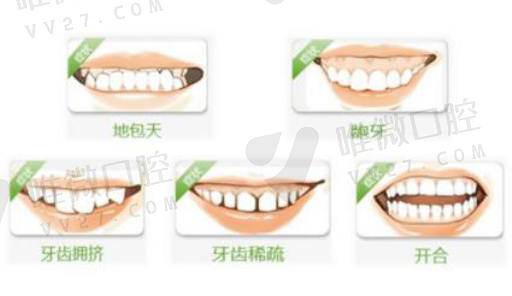 吸附性义齿可以戴几年（吸附性义齿当天做当天戴）(图1)